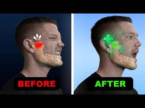 The Revolutionary New Fix For TMJ & Jaw Pain