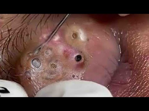 𝑹𝒆𝒎𝒐𝒗𝒊𝒏𝒈 𝑫𝒊𝒓𝒕 𝑼𝒏𝒅𝒆𝒓 𝑻𝒉𝒆 𝑺𝒌𝒊𝒏 𝑰𝒔 𝑹𝒆𝒇𝒓𝒆𝒔𝒉𝒊𝒏𝒈 𝑨𝒏𝒅 𝑹𝒆𝒍𝒂𝒙𝒊𝒏𝒈 #𝟗𝟒𝟖