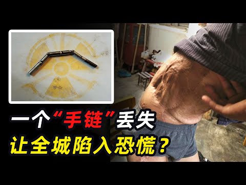 南京放射源丢失事件，男子随手捡了一个链子，花300万勉强保住双腿
