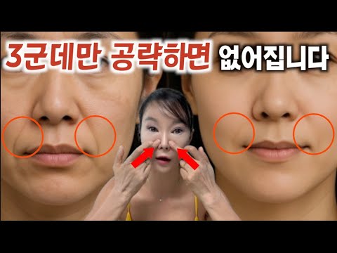 How to get rid of wrinkles on your arms: It all came down to ○○! Not plastic surgery.