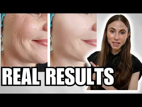 Sculptra, CO2 Laser,  Red Light Therapy: What Really Improves Skin Aging?