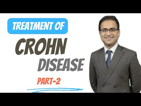 Crohn's Disease Treatment/ Management Explained, Crohns Vs Ulcerative Colitis Lecture USMLE NEETPG