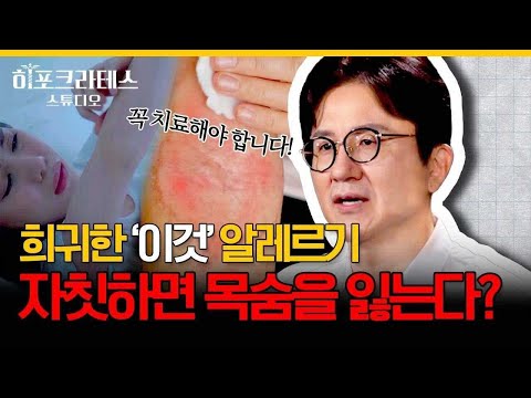 혹시 나도 알레르기 환자? 상상도 못한 특이한 알레르기 종류와 예방법 모두 알려드립니다. 꼭 확인해보세요! [서재걸의 면역내과]