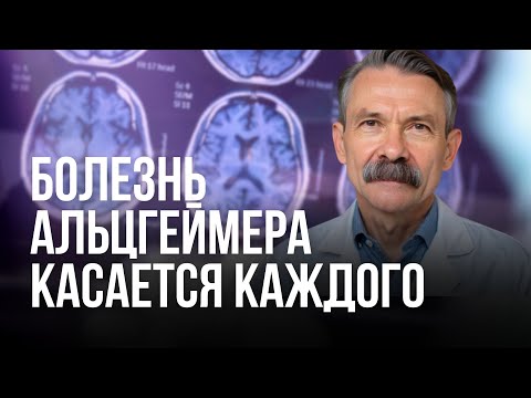 Настоящая причина болезни Альцгеймера. Профилактика деменции