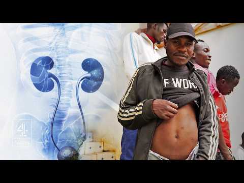 The town where Westerners buy human organs for £2,000 in Kenya