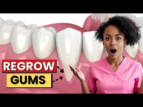 Why Your Gums Start Receding After 40 And How to Stop it