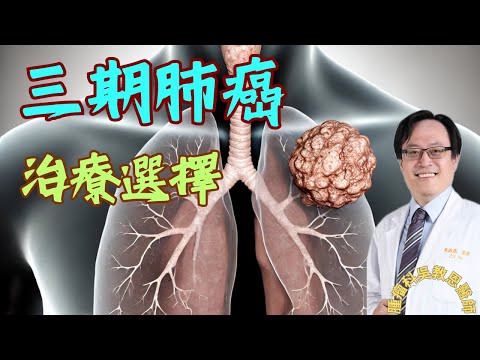 第三期肺癌的治療策略：不可開刀與可開刀的不同選擇 Stage III Lung Cancer Treatment Strategies