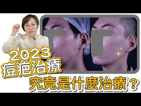 長期被痘疤困擾?2023痘疤治療的新曙光,讓你充滿自信、重拾亮眼肌膚!