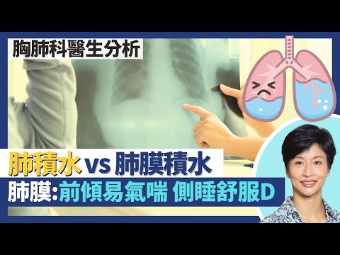 肺積水vs肺膜積水｜肺／肺膜積水異同 肺積水成因主因心臟病／肝腎衰竭！前傾較易氣喘可能係肺膜積水非肺積水！側睡一邊較舒服或是單邊肺膜積水！｜王建芳醫生 胸肺科醫生譚子雋醫生｜人類健康研究所