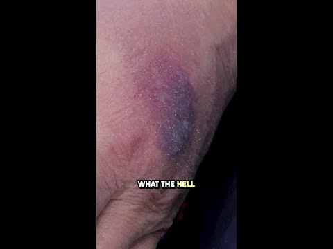 Why did it switch hands...