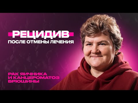 Ascites and abdominal carcinomatosis – Violetta from Ivanovo, stage 4 ovarian cancer