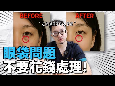 開始有眼袋的問題?必須看這影片!在家每天花5分鐘輕鬆處理。