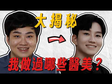 我做過哪些醫美？多年整形心得大公開！鳳凰電波、雙音波、肉毒、皮秒雷射、玻尿酸、消脂針【Joeman】