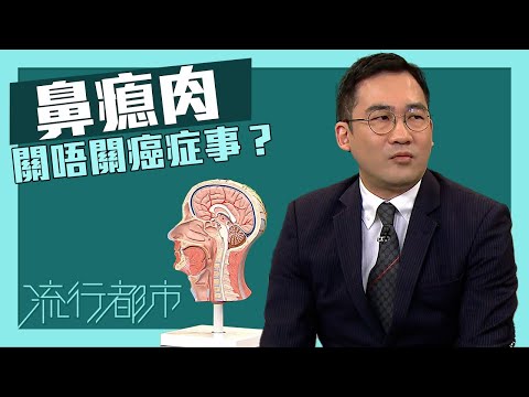 流行都市｜鼻瘜肉關唔關癌症事？｜鼻竇炎｜鼻瘜肉