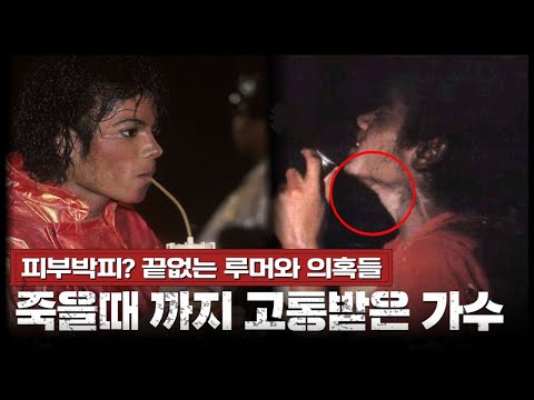 피부박피? 온갖 루머로 둘러싼 마이클 잭슨, 그는 누구인가