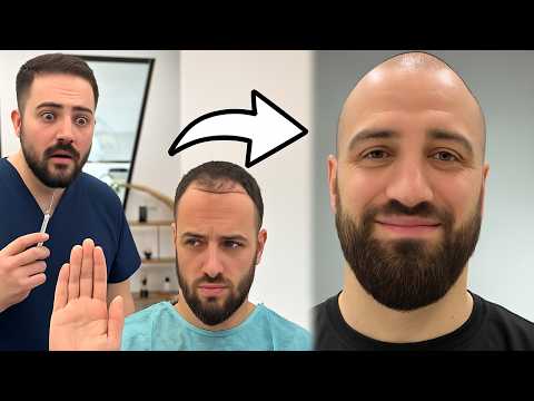 Ready for His Hair Transplant But a Shaved Head Changed Everything!