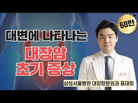 대변에 나타나는 대장암 초기 증상 / 삼성서울병원 대장항문외과 표대희
