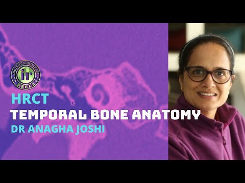 HRCT TEMPORAL BONE ANATOMY | DR ANAGHA JOSHI | OSSICLES | COCHLEA | CT MIDDLE EAR | CT INNER EAR