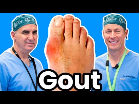 Do You Have Gout?  Here's How To Diagnose, Treat and Prevent It