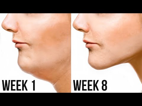 Does Mewing Actually Work?