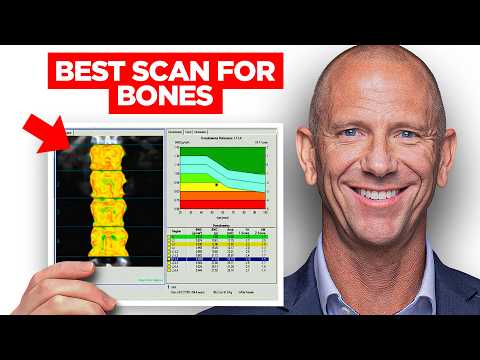 DEXA Scan vs REMS Scan:  Which Test Shows Your Real Fracture Risk? [Doctor Explains]