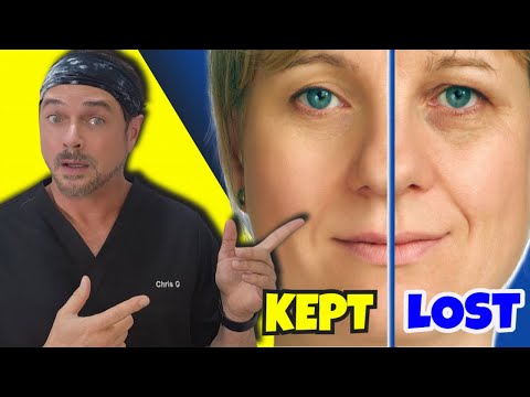 Keep Skin Younger By Stopping And Preventing Collagen Loss