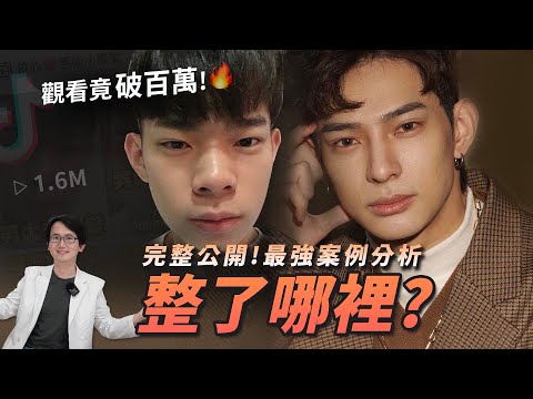 史上最強案例！路人變歐巴の逆襲關鍵？靠整形光譜走出自己風格｜依心唯美 謝東穎醫師