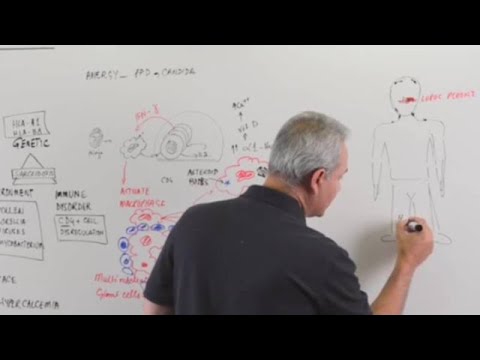 Sarcoidosis, pathophysiology clinical aspects and management