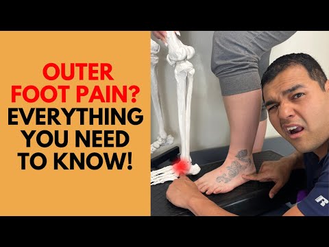 Outer Foot Pain - Everything You Need To Know About Cuboid Syndrome