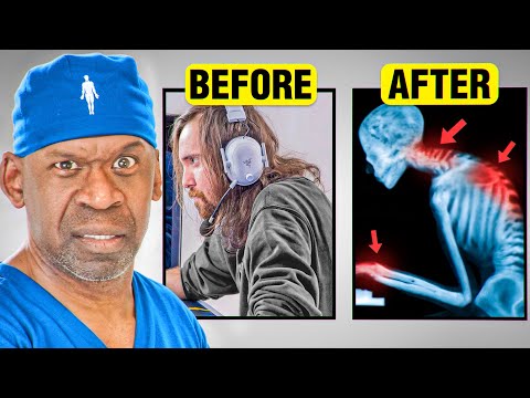 Gaming is Killing You Slowly IRL…Here’s Why | Surgeon Explains Gaming and E-Sports Injuries