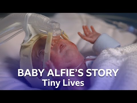 Premature Baby Alfie Arrives Three Months Early | Tiny Lives Series 2 | BBC Scotland