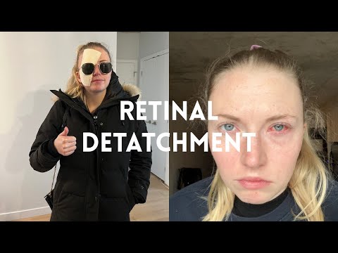 Starting 2023 with Emergency Eye Surgery - Retinal Detachment at 24