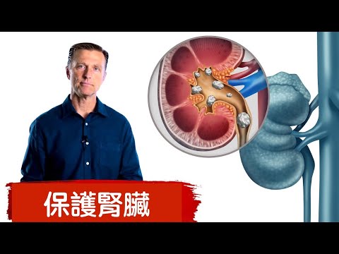 保護腎,預防腎結石不吃什麼食物？自然療法,柏格醫生 Dr Berg