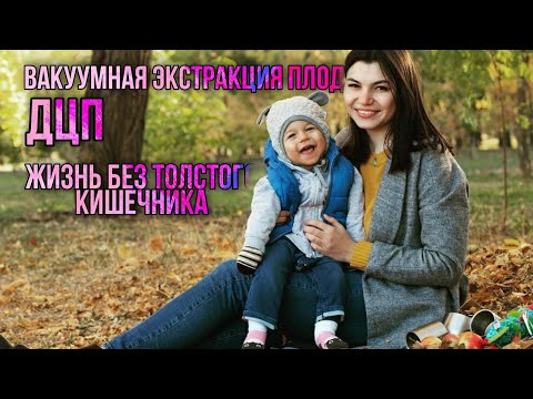 Любовь и её история родов. Асфиксия. Вакуумная экстракция плода. ДЦП. Отсутствие толстого кишечника.