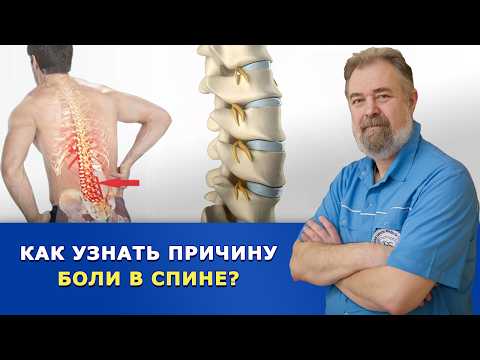 Боль в спине: мышцы, нервы, связки или суставы. Что на самом деле болит в спине?