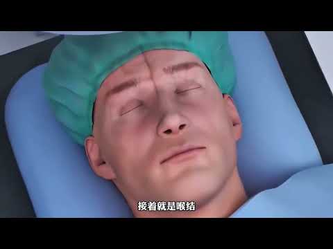 男性變性手術全過程，看完直呼太神奇了，趕快來瞭解一下吧#科普一下#熱門#男生必看#人體奧秘#冷知識