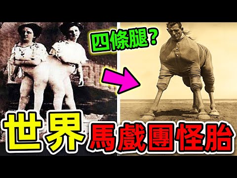 全世界最可怕的10個畸形人體！馬戲團內部拍攝的恐怖畫面，揭秘100年前“畸形秀”的背後真相。|#世界之最top #世界之最 #出類拔萃 #腦洞大開 #top10 #畸形秀 #畸形人體 #馬戲團