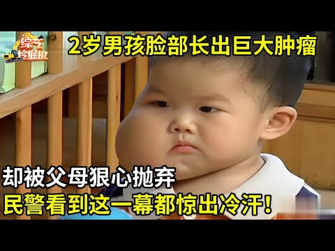 2岁男孩脸部长出巨大肿瘤,却被父母狠心抛弃,民警看到这一幕都惊出冷汗！