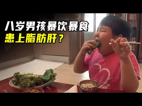 八岁男孩体重飙升，健康状况令人堪忧，妈妈的爱竟成“毒药”