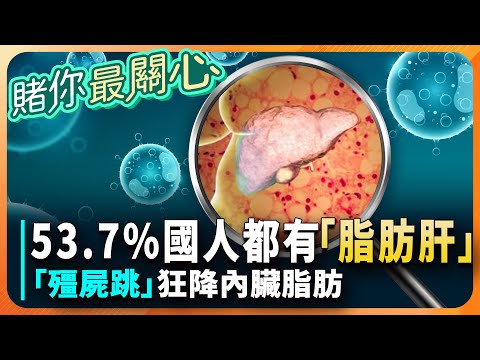 脂肪肝「很敗腎」→洗腎機率大增！專家大讚：「1居家運動」輕鬆甩掉脂肪肝！恐怖！醫揭：「肝癌3部曲」脂肪肝不只致癌、還害心血管疾病！醫：出現「4症狀」是肝功能異常！「紅茶尿、皮膚變黃」是大警訊｜祝你健康