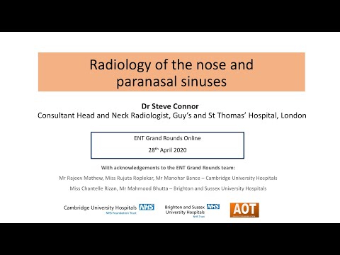 Rhinology | Radiology of the nose and paranasal sinuses | Dr Steve Connor