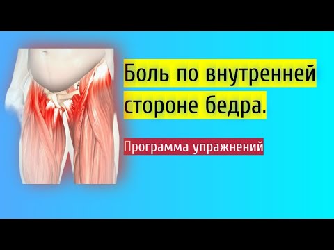 Ars синдром. Тендинит, тендинопатия приводящих мысль. Боль с внутренней стороны бедра.