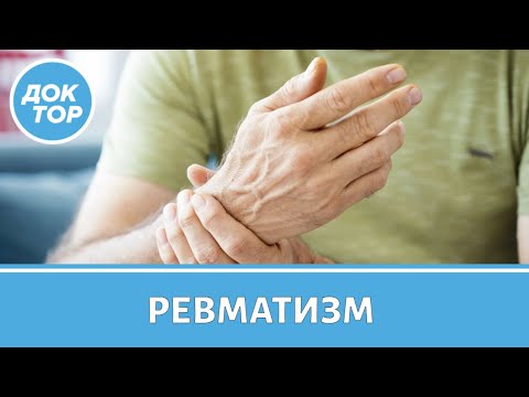 Врач–ревматолог рассказал, как обнаружить ревматизм вовремя