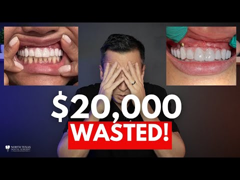 Implant Nightmares: One Woman's Dental Disaster