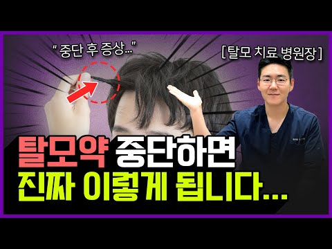 "이런 분들은 제발 탈모약 드세요..." | 탈모약은 언제까지 먹는게 가장 좋을까? (탈모약 복용기간)