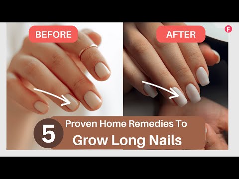5 Most Effective Home Remedies To Grow Long Nails