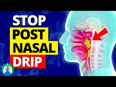 Top 10 Ways to Stop a Cough from Postnasal Drip