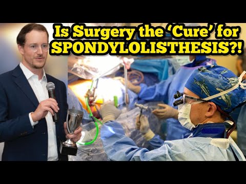 Is Surgery the 'Cure' for Spondylolisthesis?!