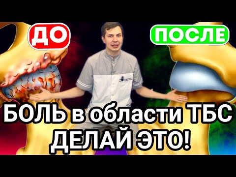 Боль в области тазобедренного сустава / Упражнения при КОКСАРТРОЗЕ /Сделал и сустав как новый до 100