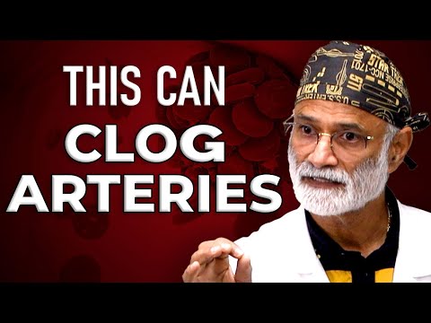 Exposing the links between Calcium, Vitamin K2, and Plaque Buildup in Blood Vessels